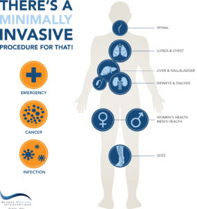 1804-024-Min-Invasive-Infographic_P2